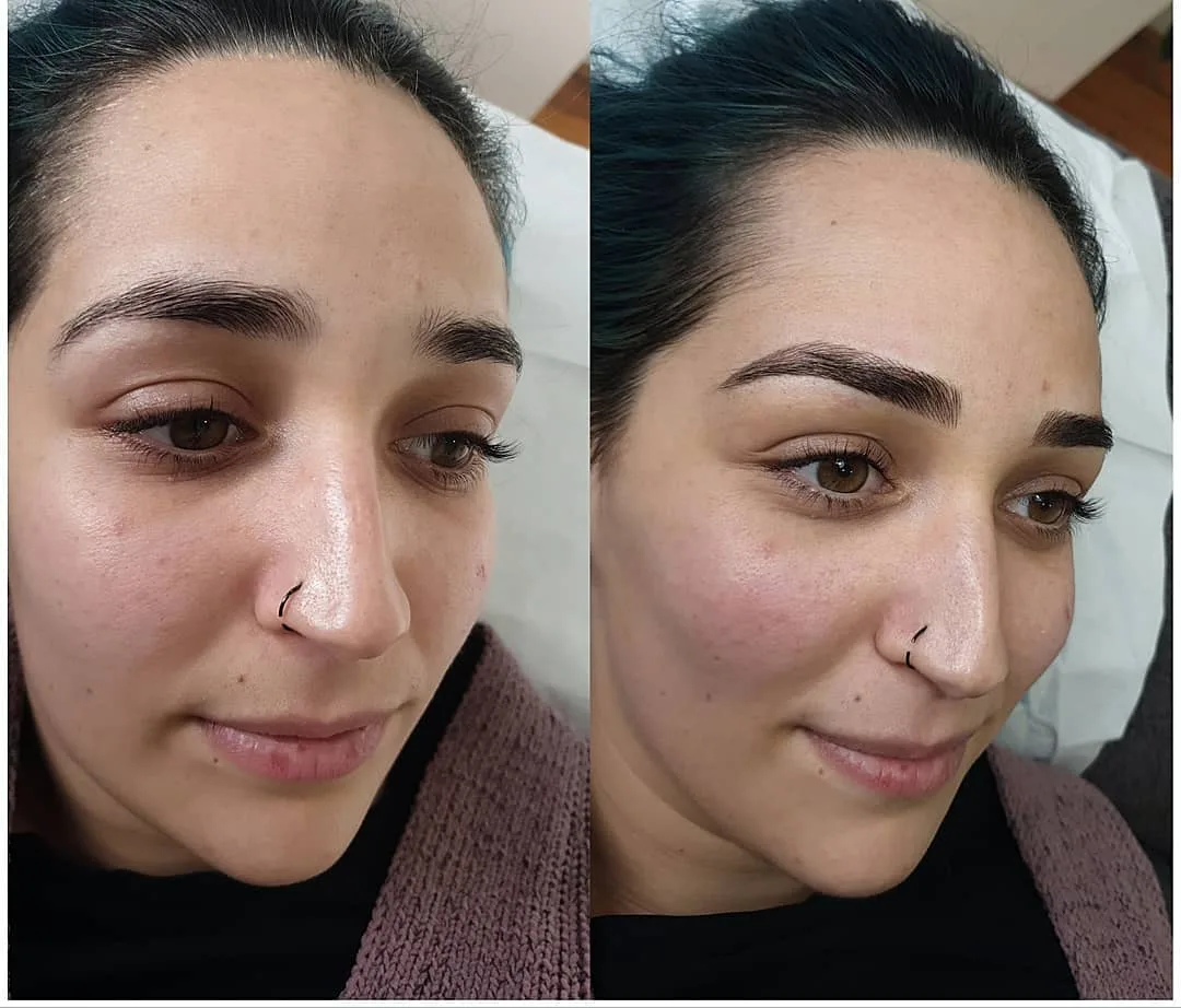 Brow shaping before and after, full-face portrait