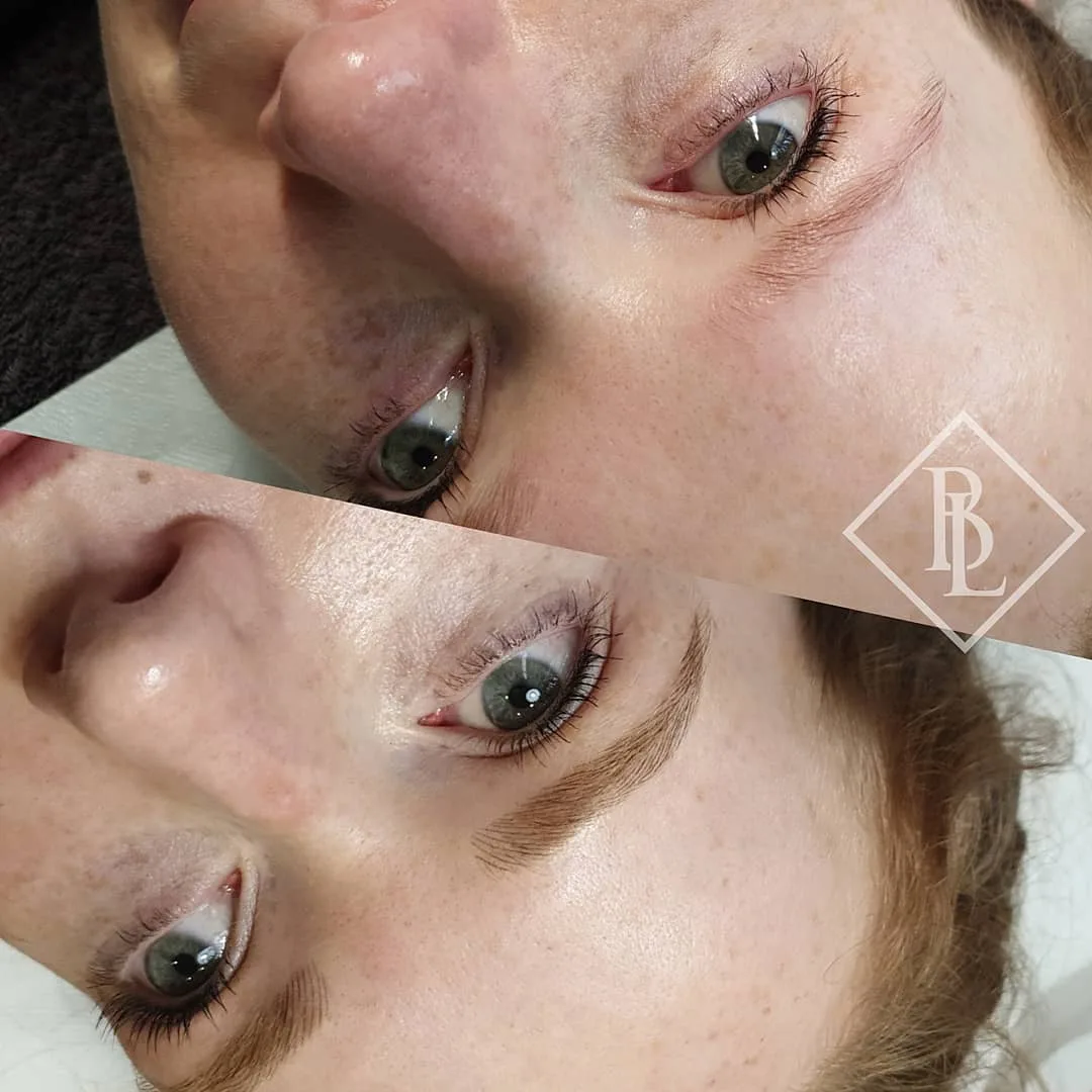 Natural brow correction before and after